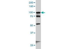 Image no. 5 for anti-Actinin, alpha 4 (ACTN4) (AA 592-701) antibody (ABIN559759)