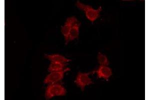 Image no. 2 for anti-Purinergic Receptor P2Y, G-Protein Coupled, 14 (P2RY14) antibody (ABIN6262049)