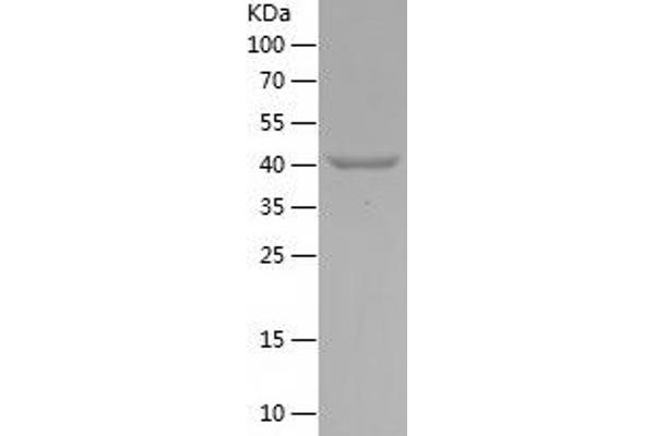 MAGEA3 Protein (AA 1-145) (His-IF2DI Tag)