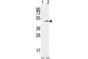 Image no. 2 for anti-SET Domain Containing 8 Pseudogene 1 (SETD8P1) antibody (ABIN2996451)