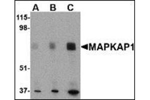Image no. 2 for anti-Transportin 1 (TNPO1) (N-Term) antibody (ABIN500230)