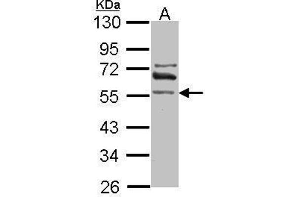 anti-Aldehyde Dehydrogenase 1 Family, Member A2 (ALDH1A2) (Center) antibody