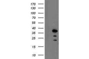 Image no. 1 for anti-Aryl Hydrocarbon Receptor Interacting Protein (AIP) antibody (ABIN1496677)