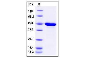 Image no. 1 for Protein Phosphatase, Mg2+/Mn2+ Dependent, 1A (PPM1A) (AA 1-382) protein (His tag) (ABIN2007606)