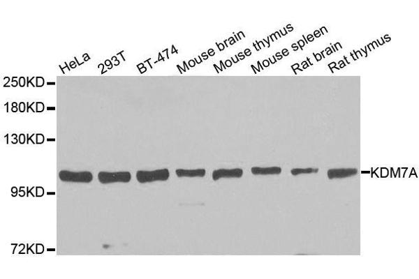 anti-Jumonji C Domain-Containing Histone Demethylase 1 Homolog D (JHDM1D) antibody