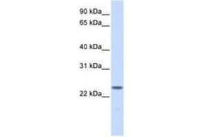 Image no. 1 for anti-Nucleophosmin/nucleoplasmin 2 (NPM2) (AA 36-85) antibody (ABIN6741439)