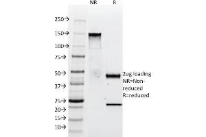 Image no. 1 for anti-Tenascin C (TNC) antibody (ABIN6939675)
