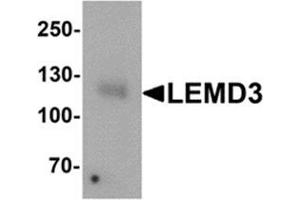 Image no. 2 for anti-LEM Domain Containing 3 (LEMD3) (C-Term) antibody (ABIN1450079)