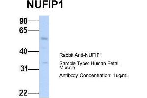 Image no. 2 for anti-Nuclear Fragile X Mental Retardation Protein Interacting Protein 1 (NUFIP1) (N-Term) antibody (ABIN2776495)