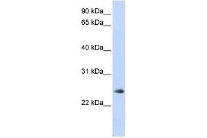 anti-Thymocyte Nuclear Protein 1 (THYN1) (Middle Region) antibody
