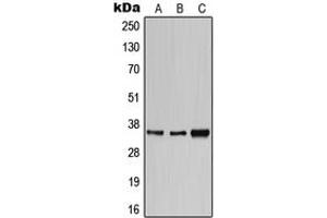Image no. 2 for anti-CD1e (CD1e) (Center) antibody (ABIN2705761)