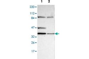 Image no. 1 for anti-Kinetochore-associated protein DSN1 homolog (DSN1) antibody (ABIN5576872)