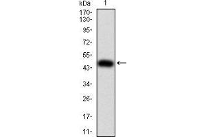 anti-Interleukin 28A (Interferon, lambda 2) (IL28A) (AA 1-200) antibody