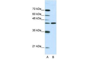 Image no. 1 for anti-Neuromedin U Receptor 2 (NMUR2) (N-Term) antibody (ABIN630112)