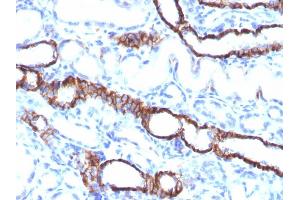 Image no. 5 for anti-Cadherin-16 (CDH16) antibody (ABIN6939024)