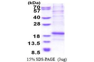 Image no. 1 for Leukocyte Cell Derived Chemotaxin 1 (LECT1) (AA 214-333) protein (His tag) (ABIN5853515)