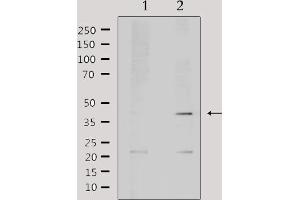 Image no. 2 for anti-Absent in Melanoma 2 (AIM2) (Internal Region) antibody (ABIN6256925)