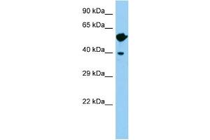 Image no. 1 for anti-Wingless-Type MMTV Integration Site Family, Member 8B (WNT8B) (C-Term) antibody (ABIN2787547)
