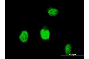 Image no. 1 for anti-Bloom Syndrome RecQ Like Helicase (BLM) (AA 1196-1295) antibody (ABIN560066)