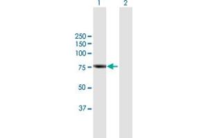 Image no. 1 for anti-Rhophilin, rho GTPase Binding Protein 2 (RHPN2) (AA 1-686) antibody (ABIN949753)
