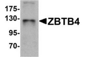 Image no. 1 for anti-Zinc Finger and BTB Domain Containing 4 (ZBTB4) (C-Term) antibody (ABIN783355)