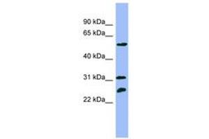 Image no. 1 for anti-Proteasome (Prosome, Macropain) 26S Subunit, ATPase, 4 (PSMC4) (N-Term) antibody (ABIN6741893)