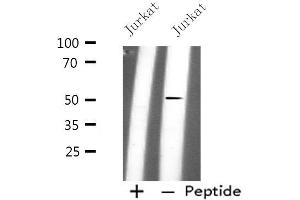 Image no. 2 for anti-Phospholipase D4 (PLD4) (C-Term) antibody (ABIN6259472)