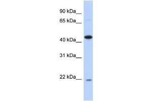 Image no. 1 for anti-RNA-Binding Protein NOB1 (NOB1) (N-Term) antibody (ABIN2785983)