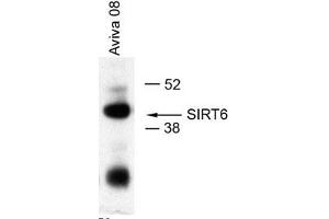 Image no. 2 for anti-Sirtuin 6 (SIRT6) (Middle Region) antibody (ABIN2779624)