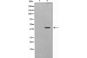 CBX6 antibody  (N-Term)