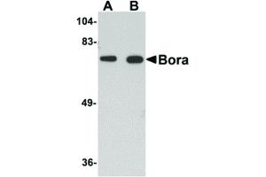 Image no. 1 for anti-Protein Aurora Borealis (BORA) (C-Term) antibody (ABIN6656971)