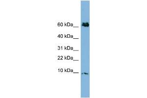 Image no. 2 for anti-Cysteine-Rich Protein 1 (Intestinal) (CRIP1) (N-Term) antibody (ABIN2784545)