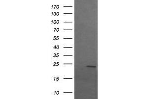 Image no. 2 for anti-Sex Determining Region Y (SRY) antibody (ABIN1501139)