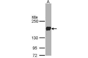 Image no. 1 for anti-Protocadherin 1 (PCDH1) (Center) antibody (ABIN2855706)