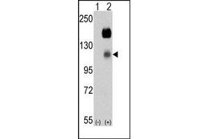 Image no. 1 for anti-PTK7 Protein tyrosine Kinase 7 (PTK7) (N-Term) antibody (ABIN360111)