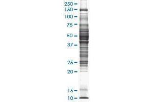 Image no. 1 for Rat liver tissue lysate (non-denatured) (ABIN1339615)
