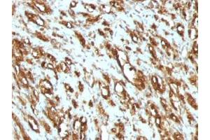 Immunohistochemistry (Formalin-fixed Paraffin-embedded Sections) (IHC (fp)) image for anti-Pan Muscle Actin antibody (ABIN3026683)