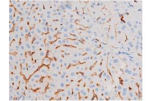 Image no. 1 for anti-Insulin Receptor Substrate 1 (IRS1) (pSer639) antibody (ABIN6256390)