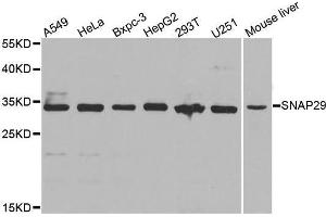 Image no. 1 for anti-Synaptosomal-Associated Protein, 29kDa (SNAP29) antibody (ABIN1682838)