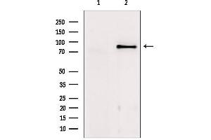 Image no. 2 for anti-Transforming, Acidic Coiled-Coil Containing Protein 1 (TACC1) antibody (ABIN6265428)