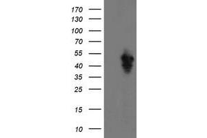 Image no. 1 for anti-serpin Peptidase Inhibitor, Clade E (Nexin, Plasminogen Activator Inhibitor Type 1), Member 2 (SERPINE2) antibody (ABIN2731827)