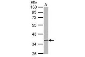 Image no. 1 for anti-NudE Neurodevelopment Protein 1 (NDE1) (AA 1-203) antibody (ABIN1499654)
