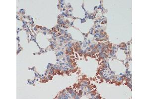 Immunohistochemistry of paraffin-embedded Mouse lung using CHAT Polyclonal Antibody at dilution of 1:200 (40x lens).