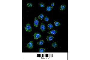 Image no. 2 for anti-Poly(A) Binding Protein, Nuclear 1-Like (Cytoplasmic) (PABPN1L) (AA 166-194) antibody (ABIN655857)