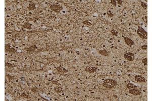 ABIN6279449 at 1/100 staining Rat brain tissue by IHC-P.