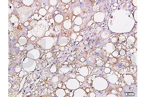 Formalin-fixed and paraffin embedded: rat liver labeled with Anti-Leptin Polyclonal Antibody (ABIN725030), Unconjugated 1:300 followed by conjugation to the secondary antibody and DAB staining