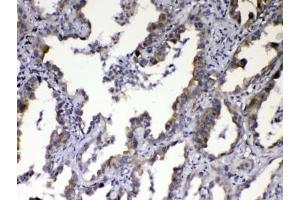 Image no. 1 for anti-Nephroblastoma Overexpressed (NOV) (AA 334-357) antibody (ABIN5647955)