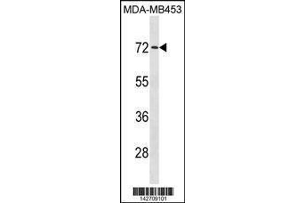 anti-Mex-3 Homolog C (C. Elegans) (MEX3C) (AA 536-564), (C-Term) antibody