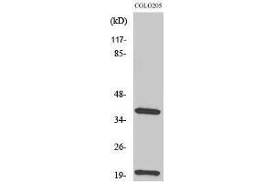 TCR beta antibody  (Internal Region)