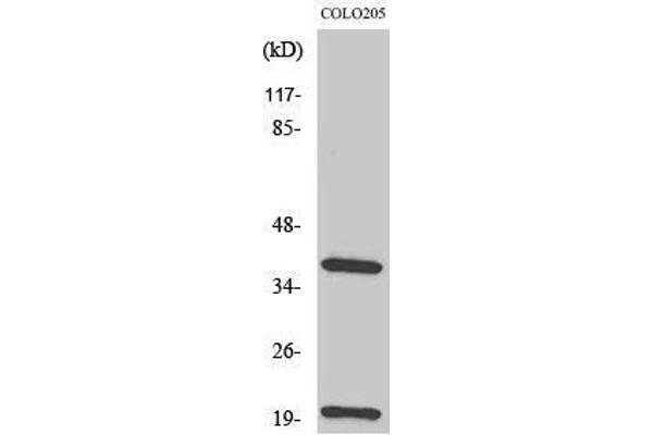 TCR beta antibody  (Internal Region)